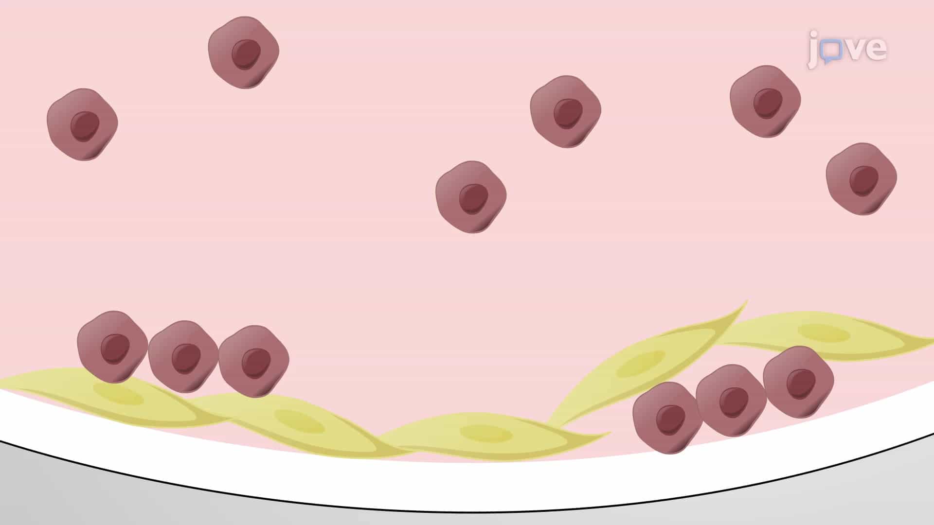 Leukemic Subpopulation Harvest: A Method for Spatial Separation of Leukemic Cell Subpopulations from 2D Co-culture