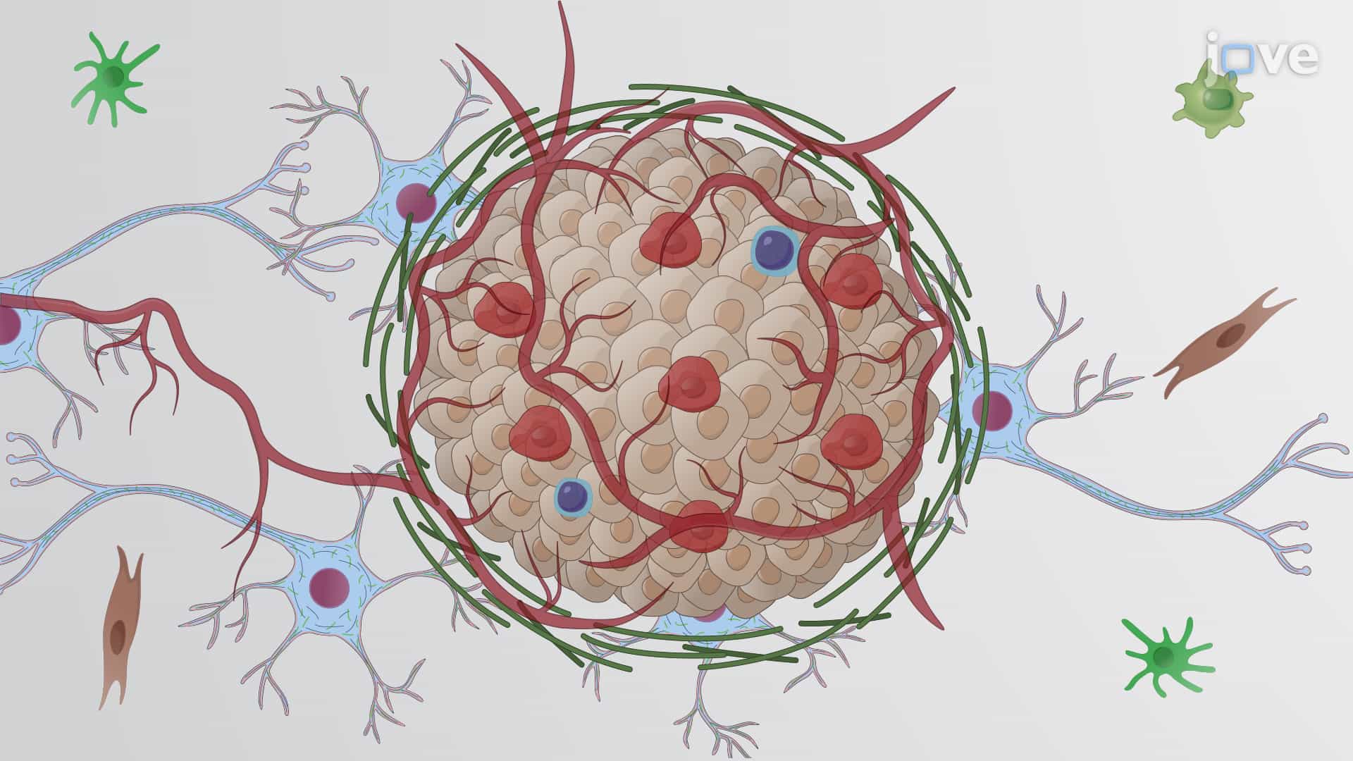 Luciferase-tagged Glioma Stem Cell Model: A Lentivirus-mediated Method to Prepare Luciferase-tagged Glioma Stem Cells for In Vitro Therapeutic Studies