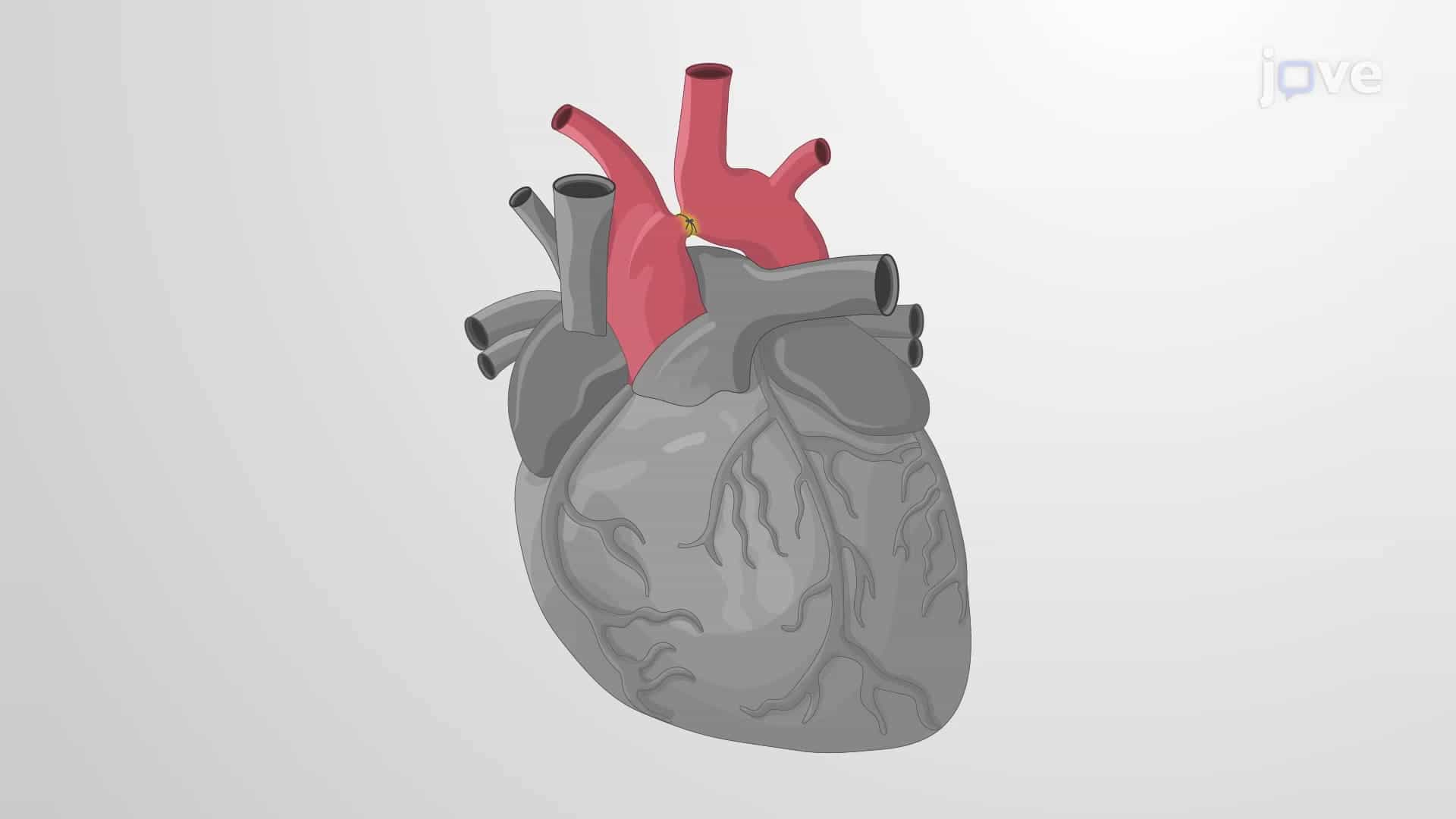 Transverse Aortic Arch Banding in Mouse Model: A Minimally Invasive Technique in Mice for Induction of High Pressure in the Left Ventricle