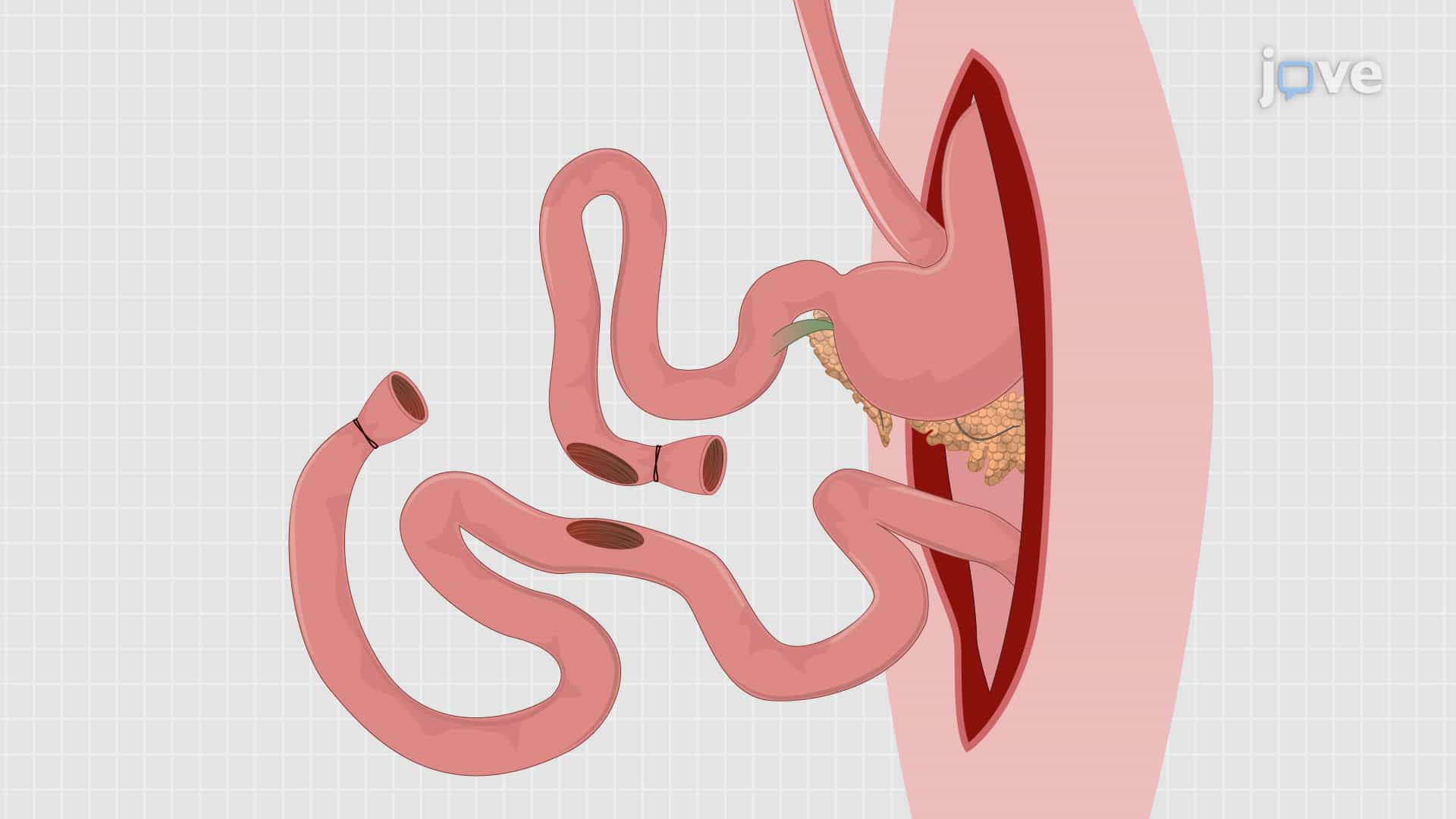 Roux-en-Y Gastric Bypass Procedure: A Bariatric Surgical Procedure for Gastric Resectioning in Murine Model