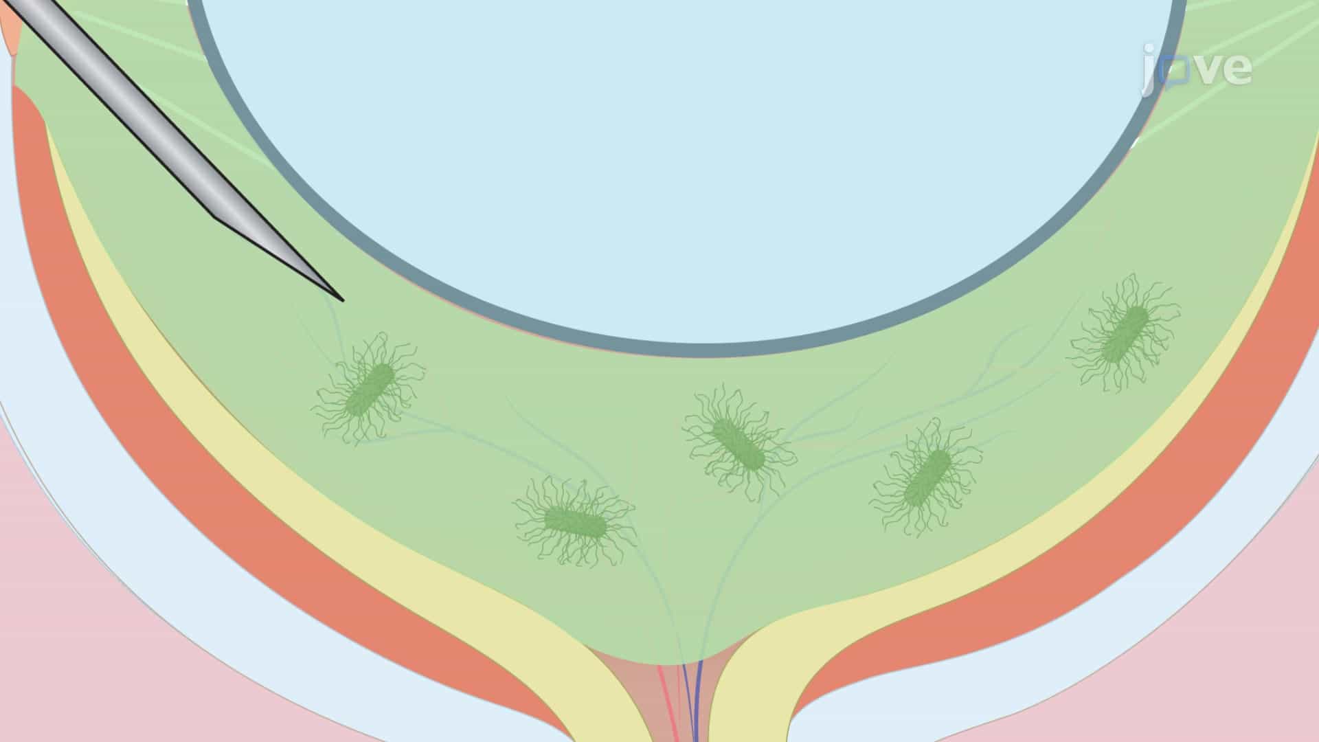 Bacterial Endophthalmitis Mouse Model: A Method for Generating Bacterial Endophthalmitis via Intravitreal Injection of Bacterial Suspension into Eye of Mouse