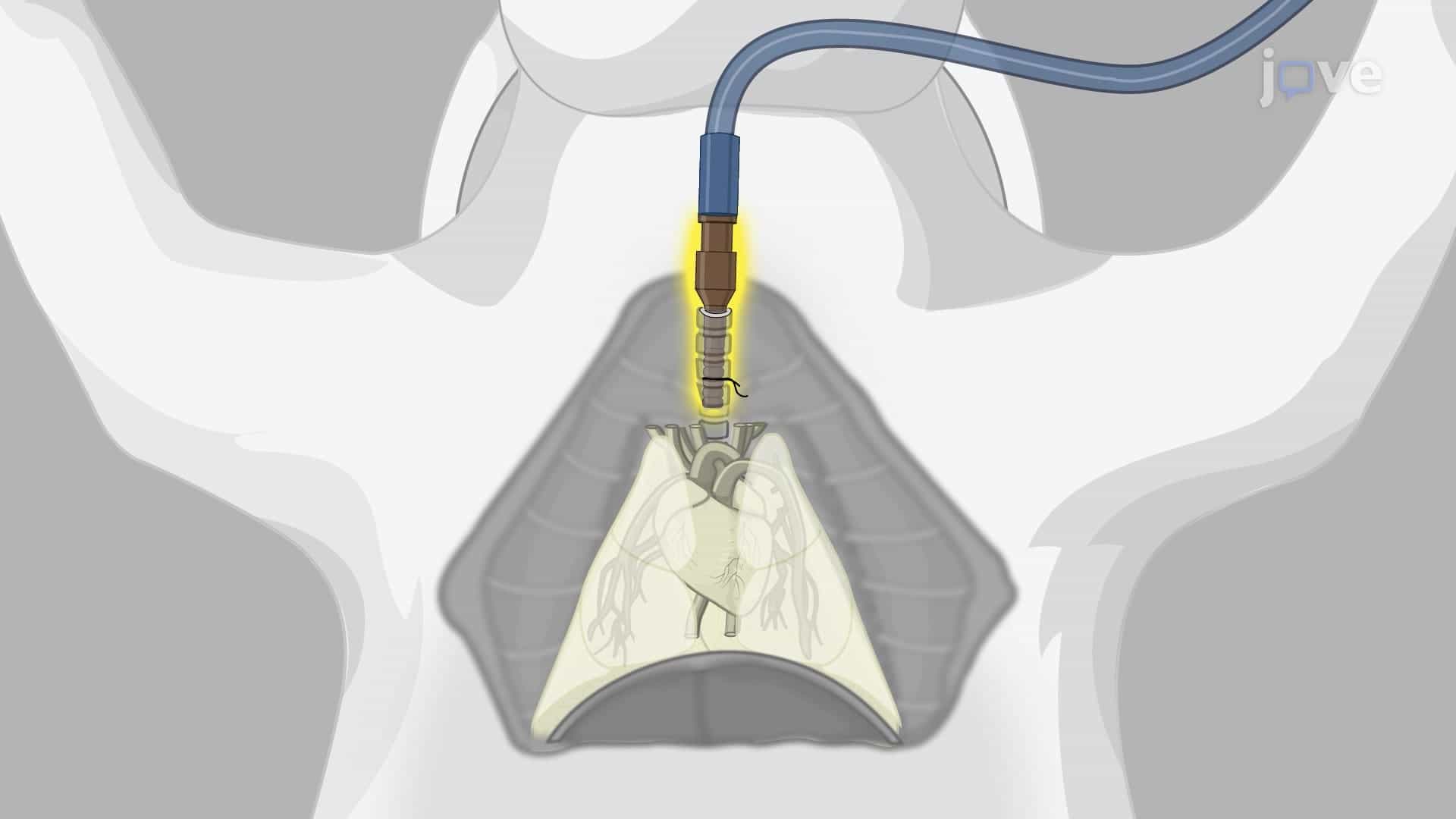 Cardiopulmonary Block Harvest from Rabbit: A Surgical Procedure to Retrieve Functional Heart-Lung Block from Rabbit Model