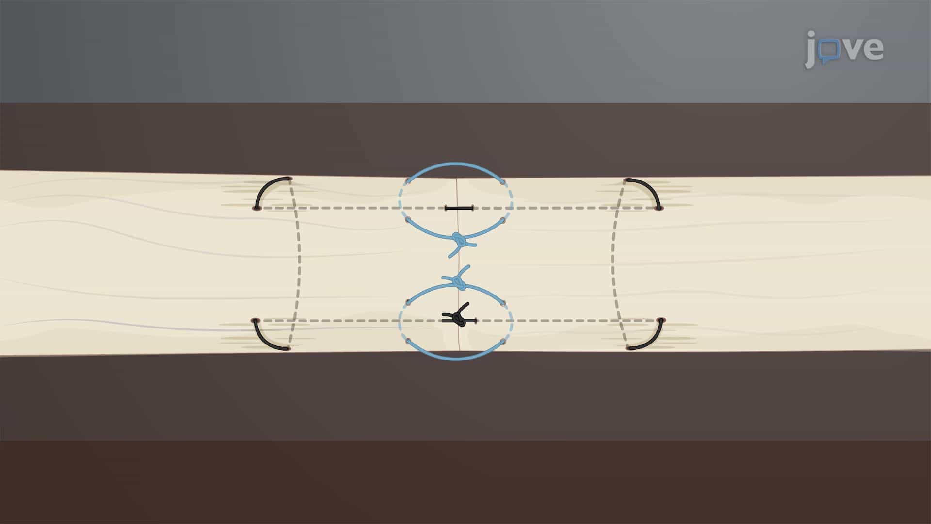 Q Suture Technique: A Suturing Technique to Reduce Gap Formation and Increase Tensile Strength in Tendon Repair