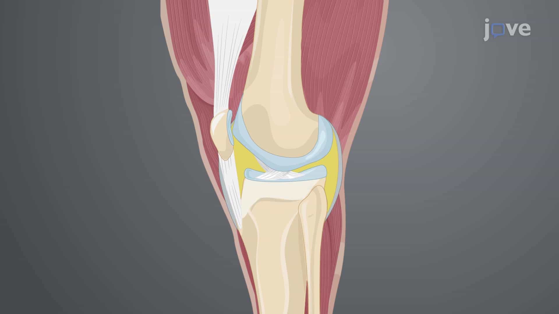 Harvesting Articular Cartilage From Joints of an Equine Donor: A Surgical Procedure to Isolate Vascular Connective Tissue From Cadaveric Joints of an Equine Donor