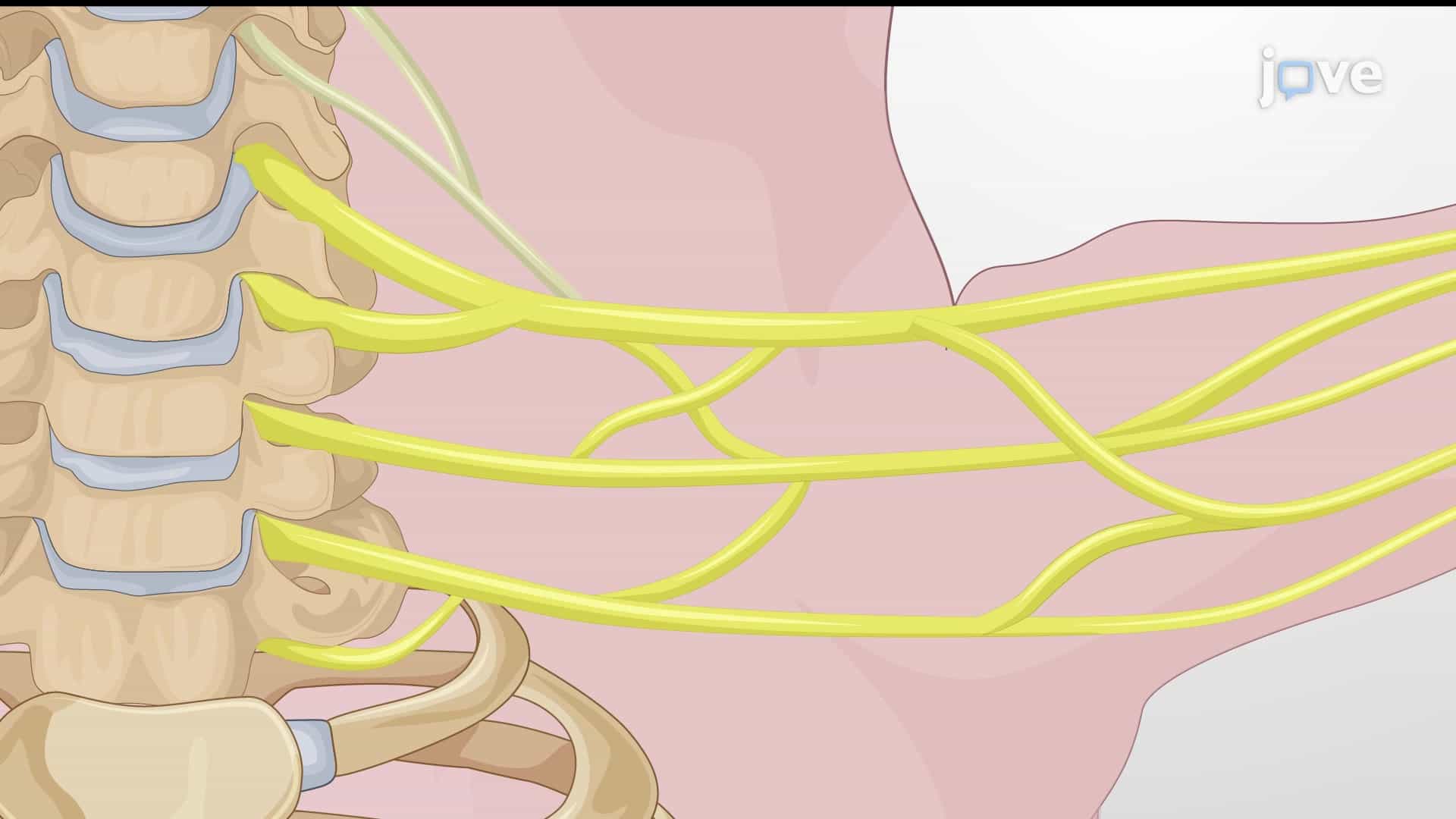 Exposing Brachial Plexus: A Surgical Technique to Visualize Brachial Plexus in Neonatal Piglet