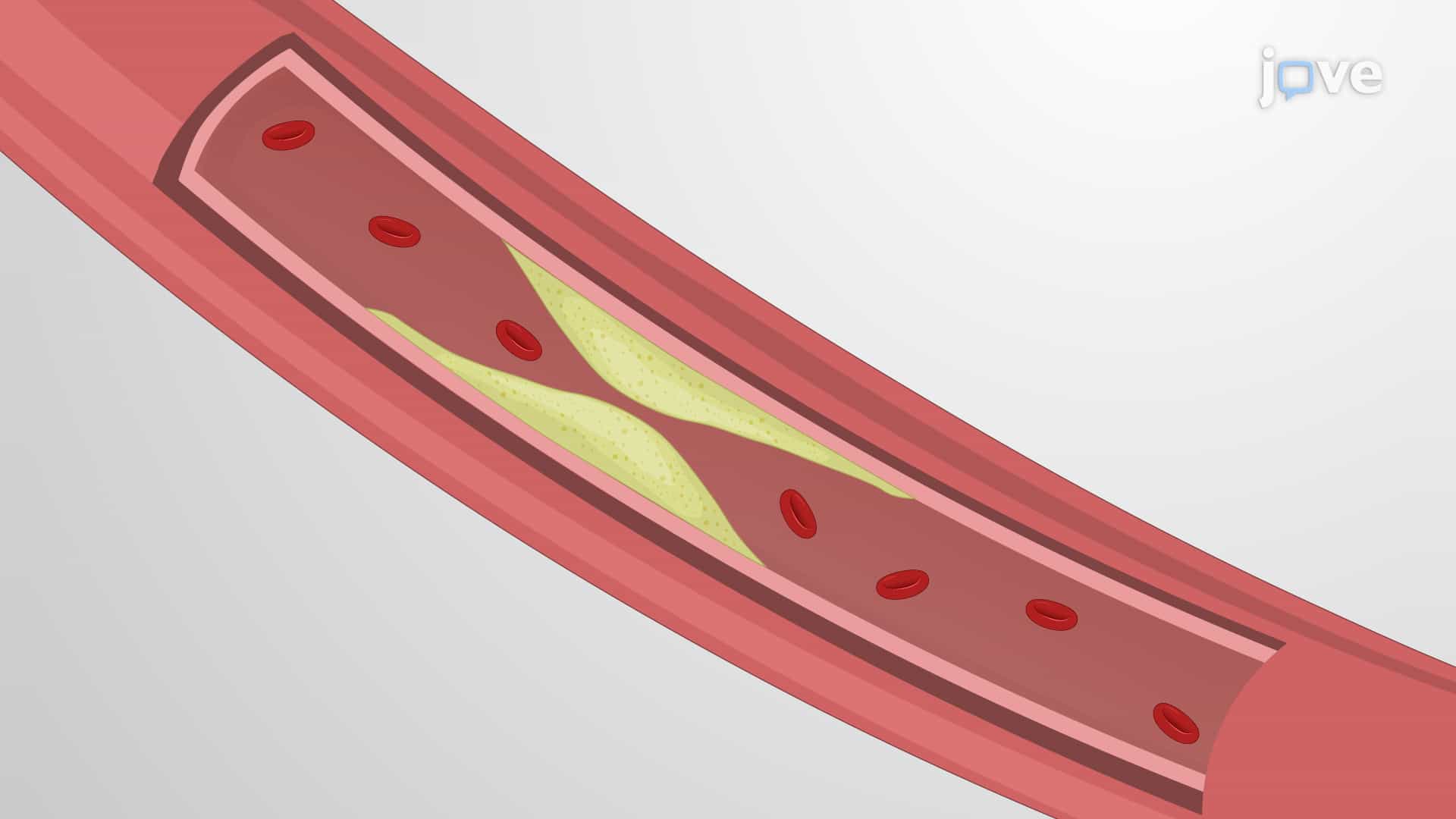 Assessing Vessel Perfusion via Angiography: A Technique to Introduce Contrast Agent in Descending Aorta to Visualize Blood Vessel Perfusion in Rabbit Model
