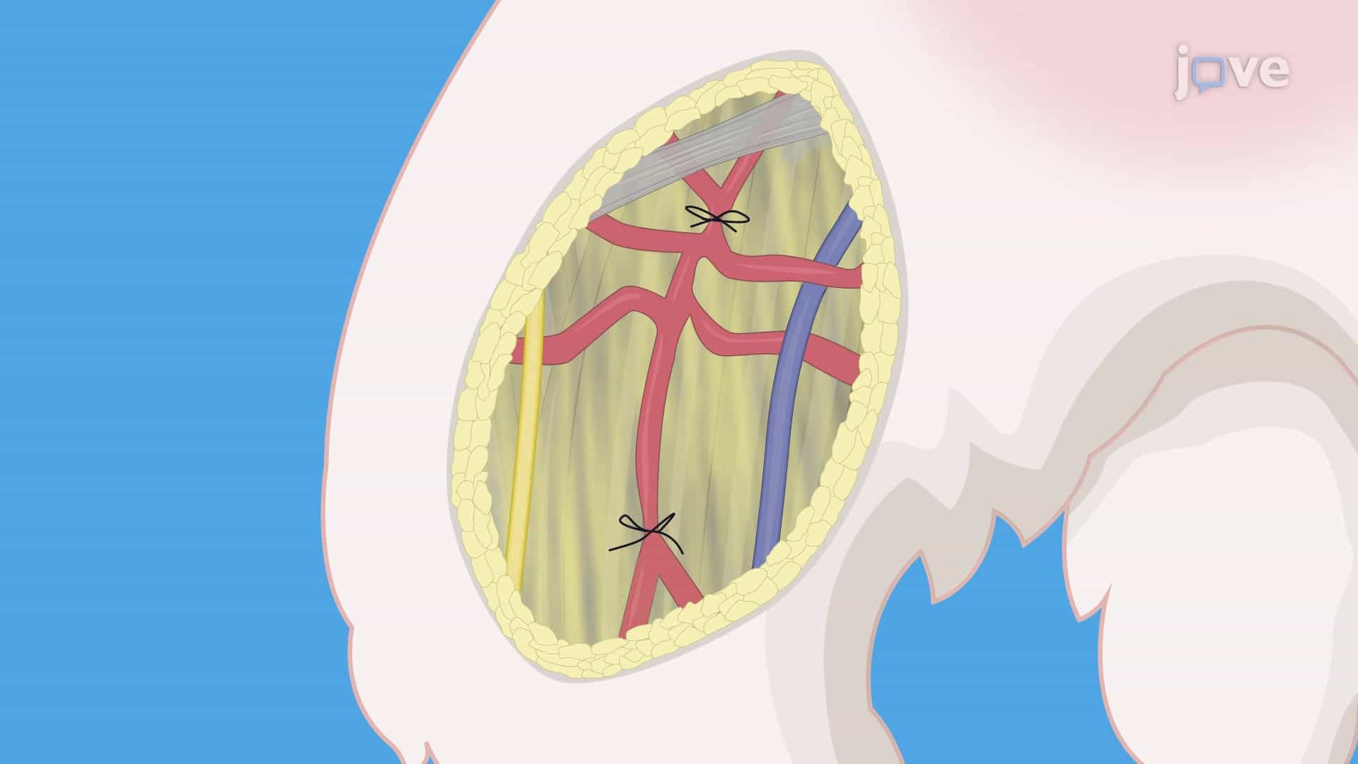 An Experimental Model of Peripheral Ischemia: A Procedure to Generate Peripheral Ischemia via Femoral Artery Ligation in a Rabbit