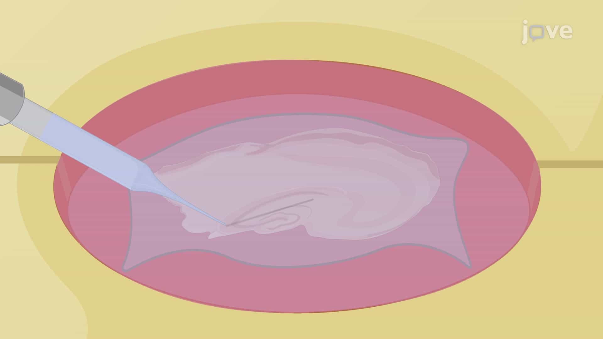Electroencephalography-Based Recording Technique to Record the Epileptiform Activity