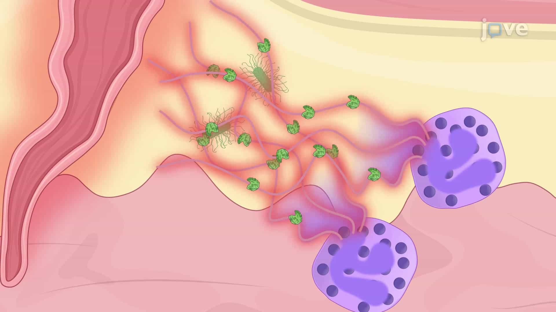 An In Vitro Technique to Generate Human Neutrophil Extracellular Traps