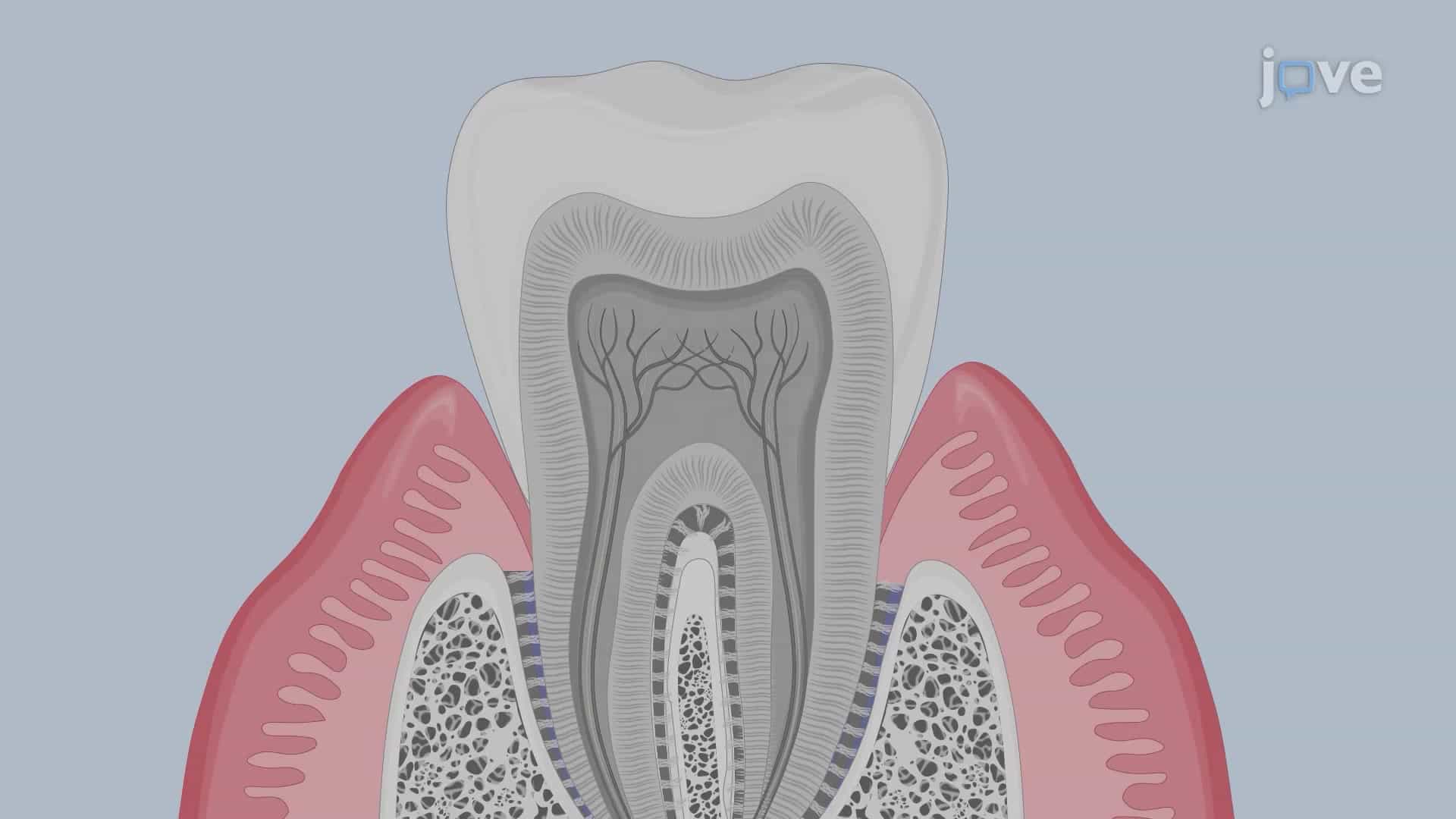 Isolation of Gingival Immune Cell Network from Murine Teeth Blocks