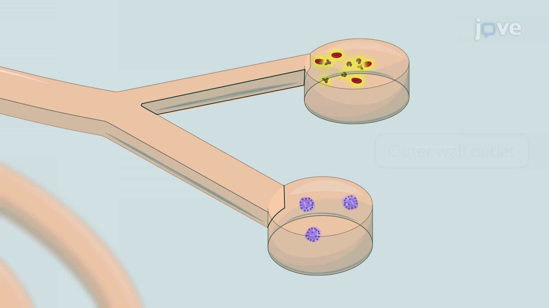 Label-Free Neutrophil Separation from Tracheal Secretion Using Spiral Microfluidics Channel