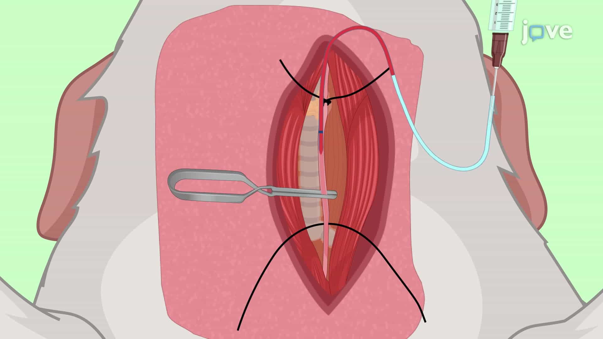 Cannulation of the Carotid Artery in a Rat Model