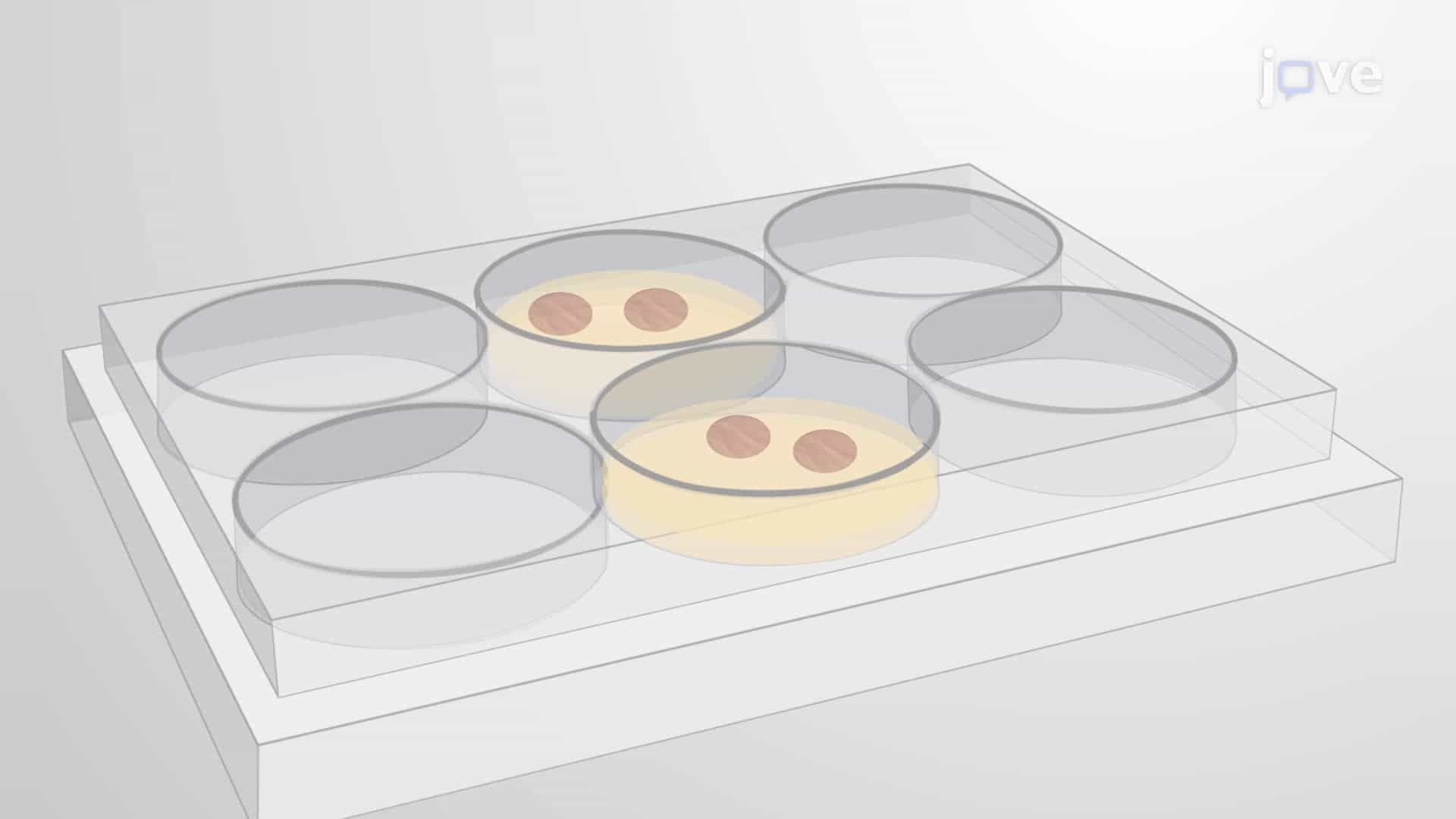 Agarose-Based Preparation of Human Precision-Cut Lung Slices