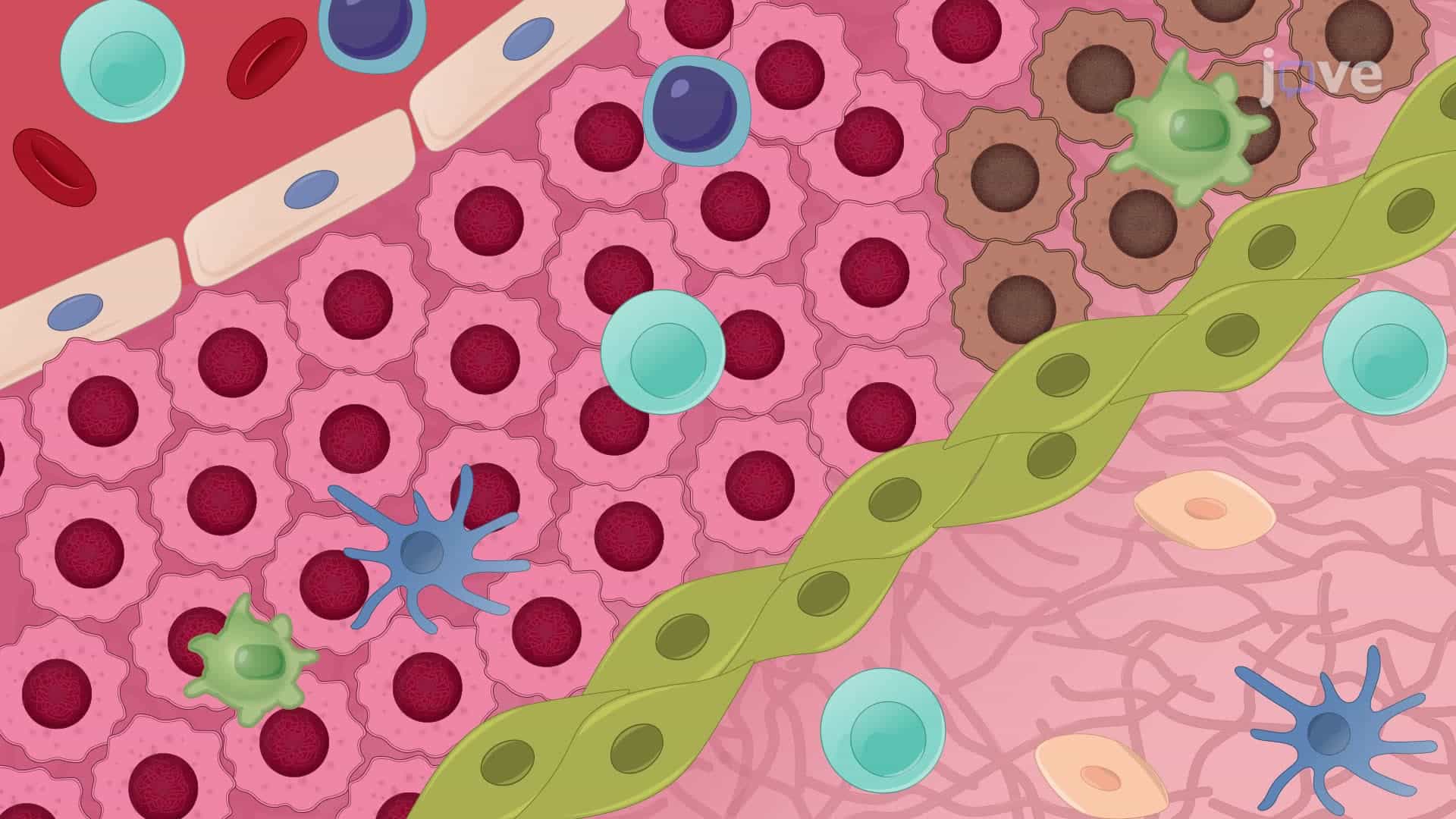 Real-Time Analysis of Resident T-cell Migration in Different Tumor Regions Using Confocal Microscopy