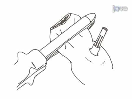 The C-seal: A Biofragmentable Drain Protecting the Stapled Colorectal Anastomosis from Leakage