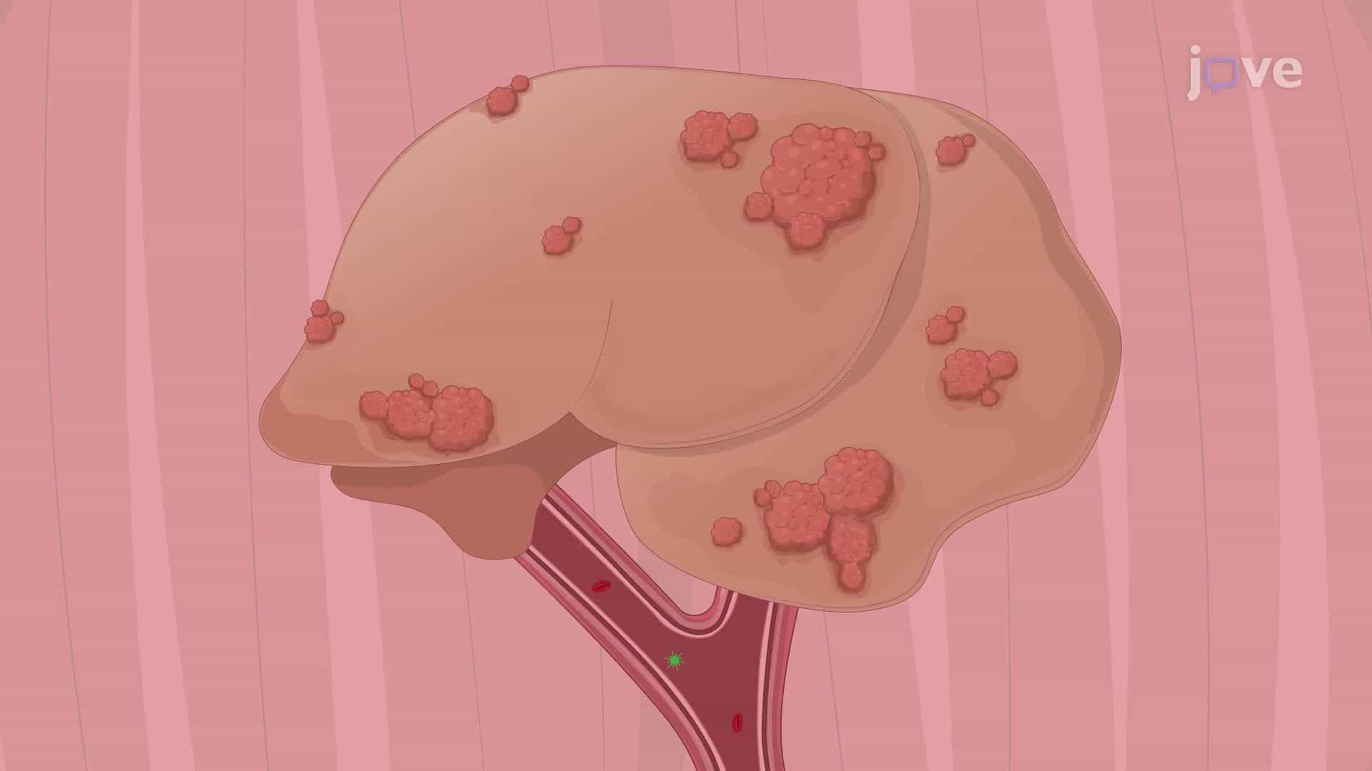 Targeting Liver Tumors with Oncolytic Viruses via the Hepatic Artery