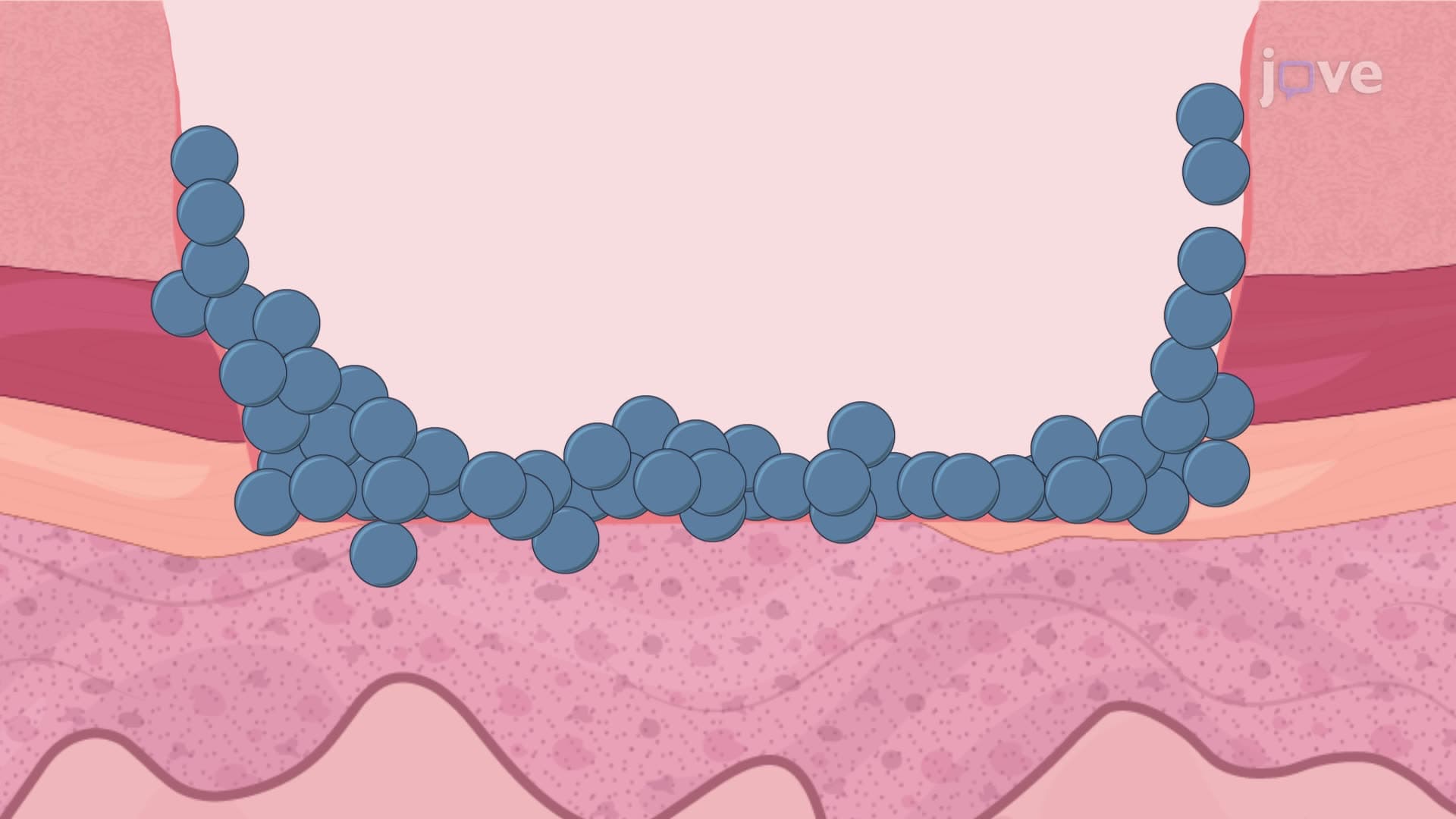 Generating an Ex Vivo Ovine Wounded Skin Model Infected with a Bacterial Pathogen