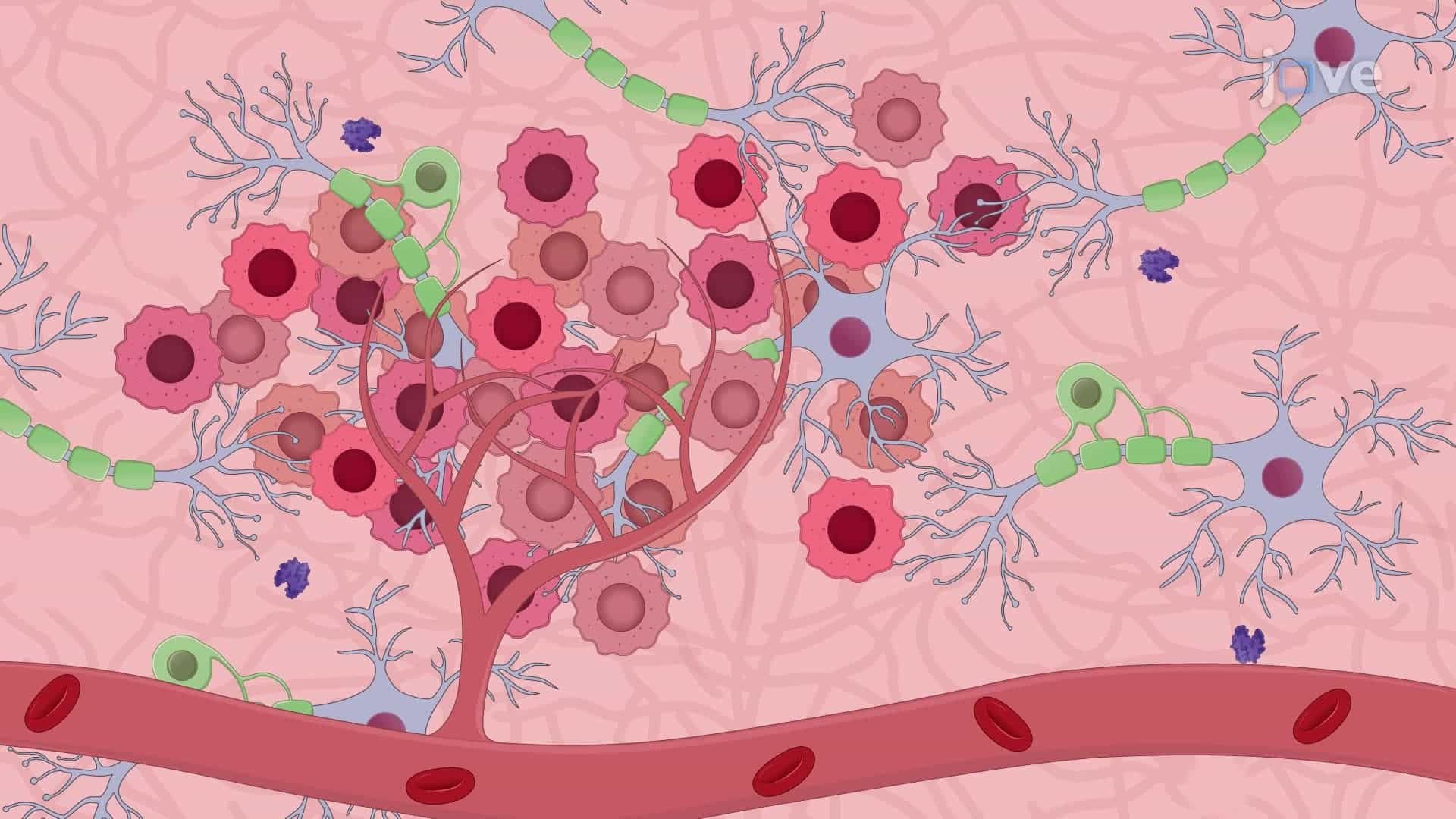 Isolating and Culturing Cells from Diffuse Intrinsic Pontine Glioma