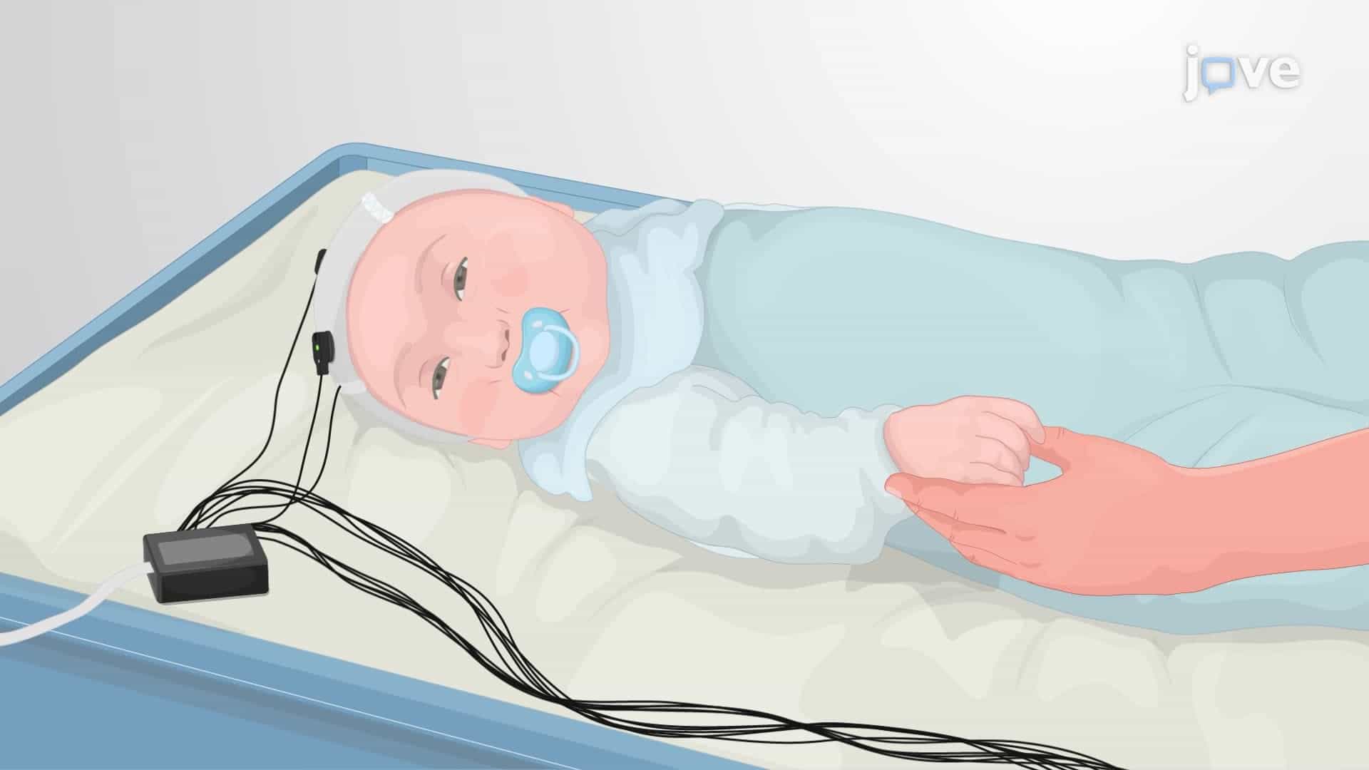 Measuring Pain-Evoked Brain Activity in Neonates Using a Flat-Tip Probe Coupled to EEG