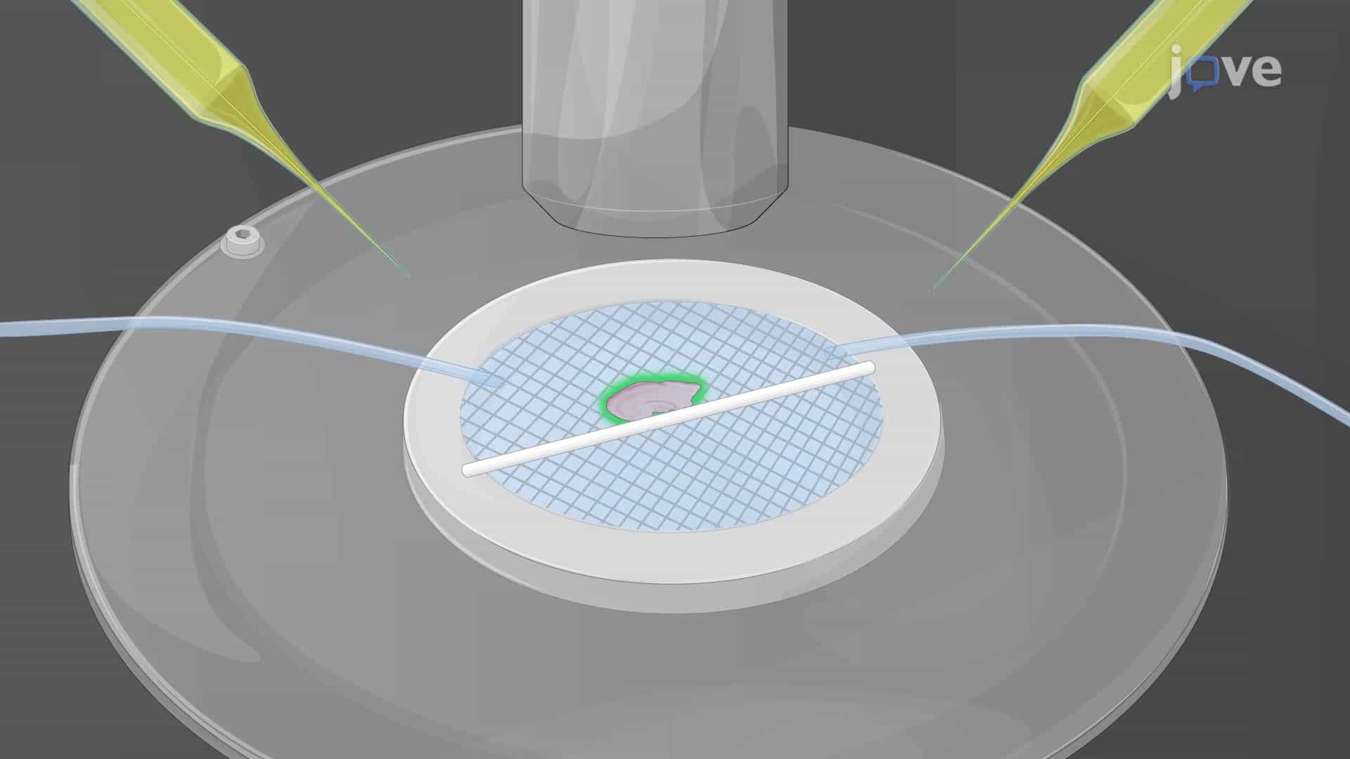 In Vitro Recording of Theta Oscillations in the Mouse Hippocampus