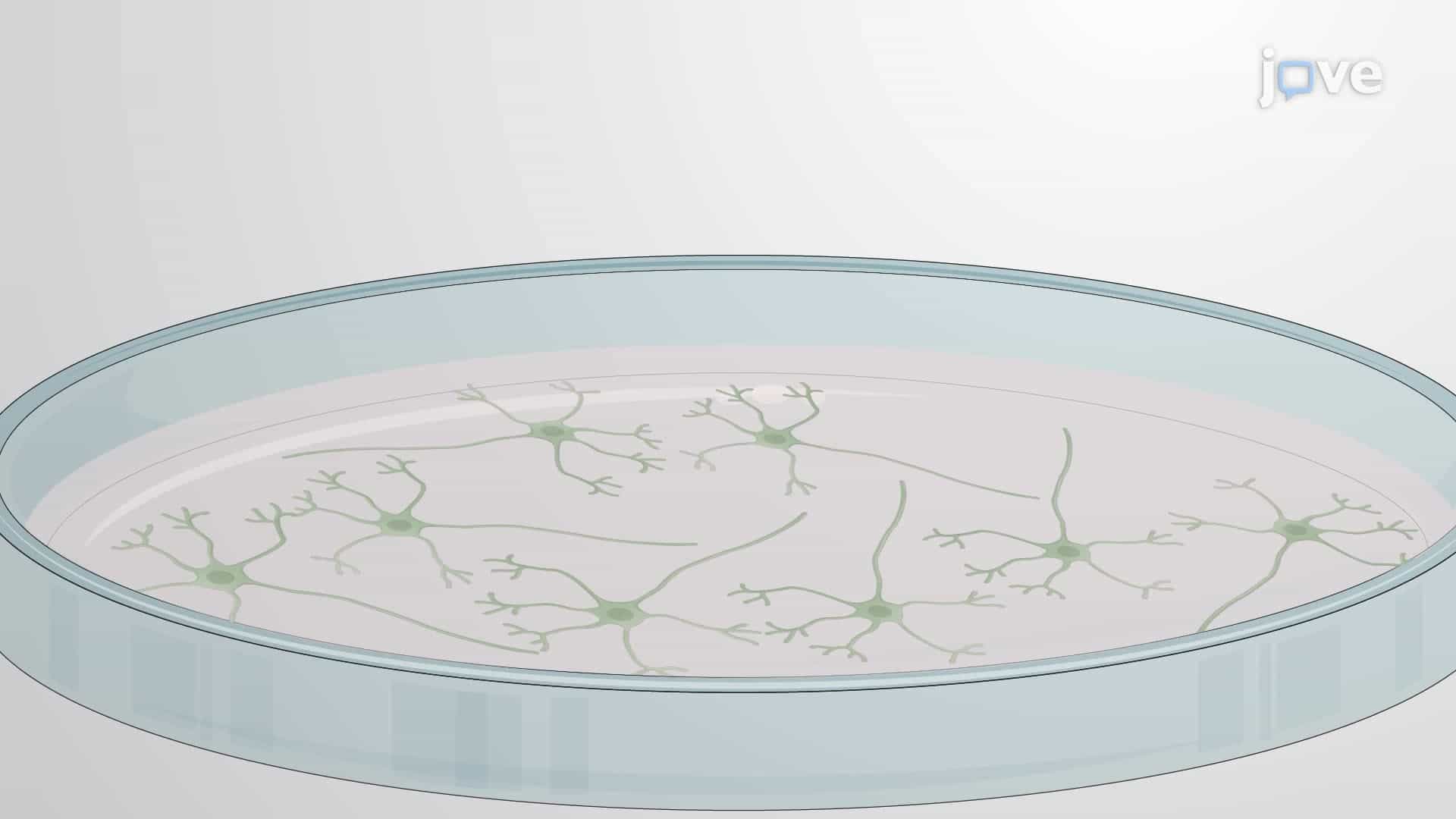 Modeling Neuronal Injury in Mouse Primary Cerebellar Granule Neurons