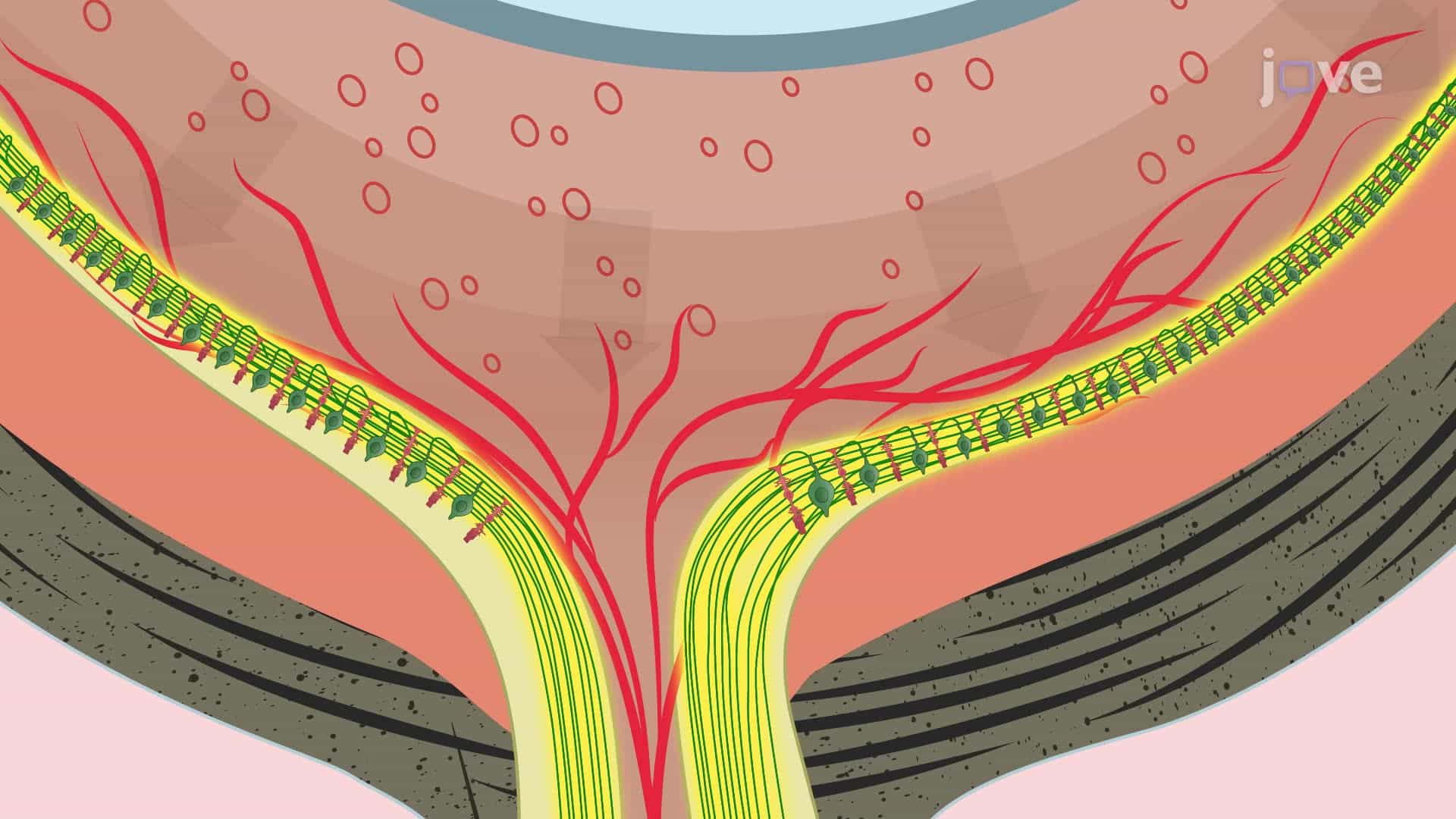 A Hypertonic Saline Injection Technique for Inducing Glaucoma in Rats
