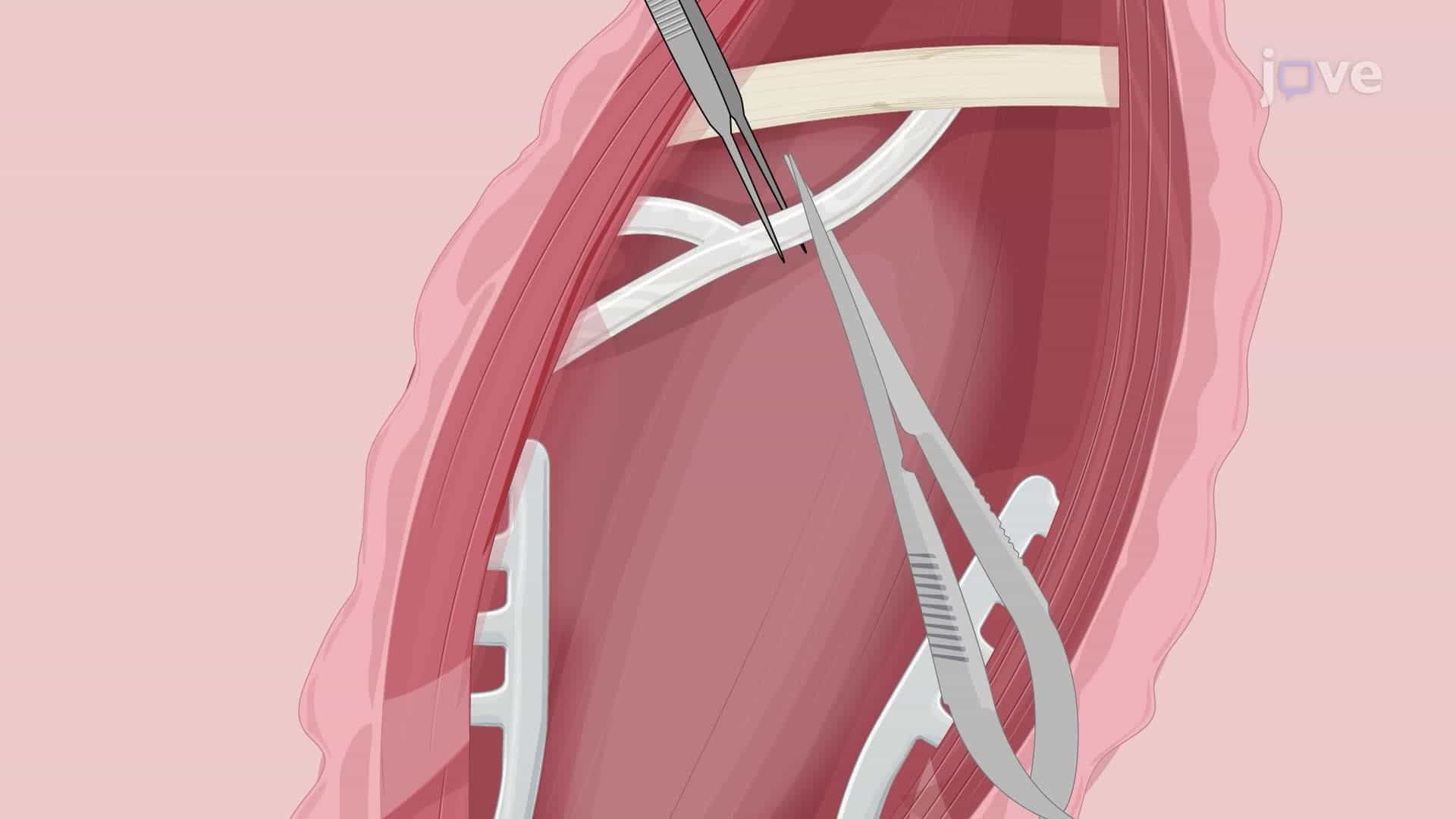 Inducing a Facial Nerve Injury in a Rat Model