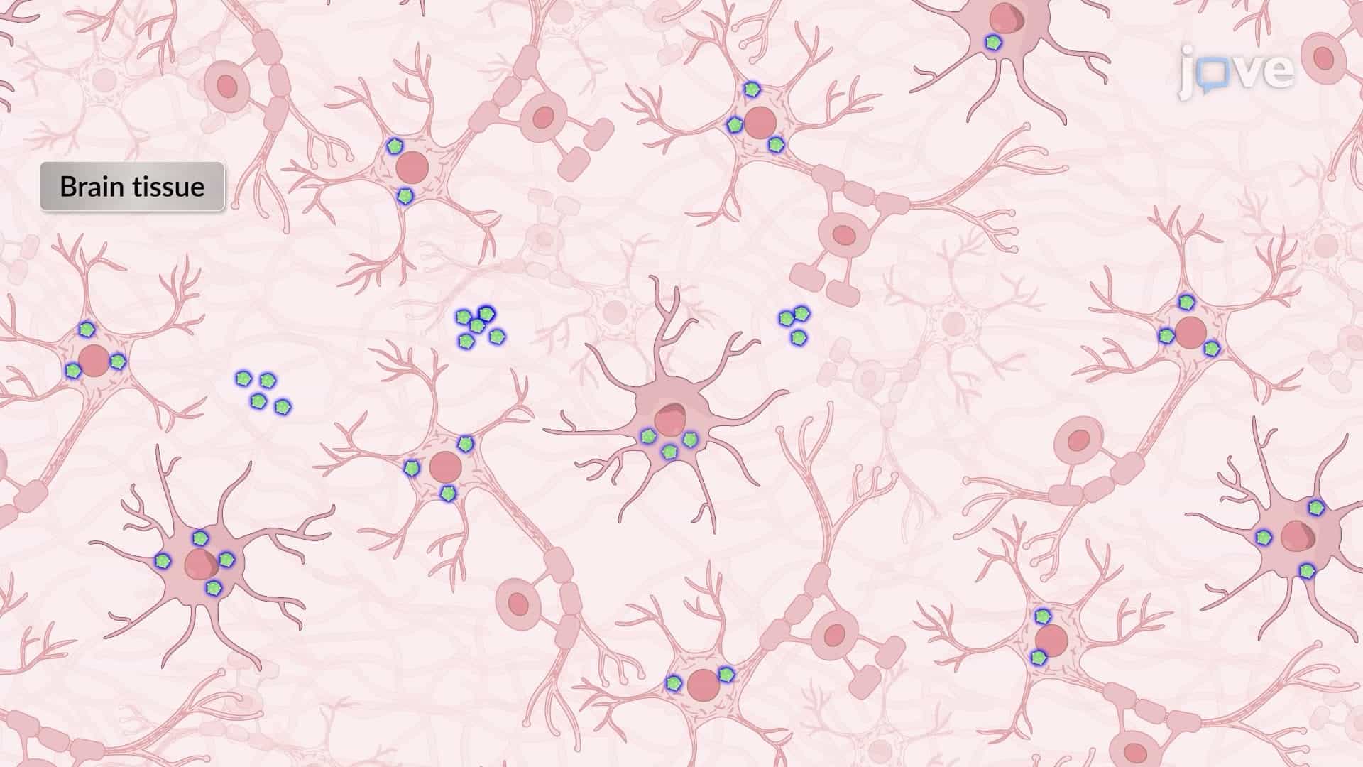 Immunohistochemical Detection of Pathogenic Bacteria in Human Brain Tissue