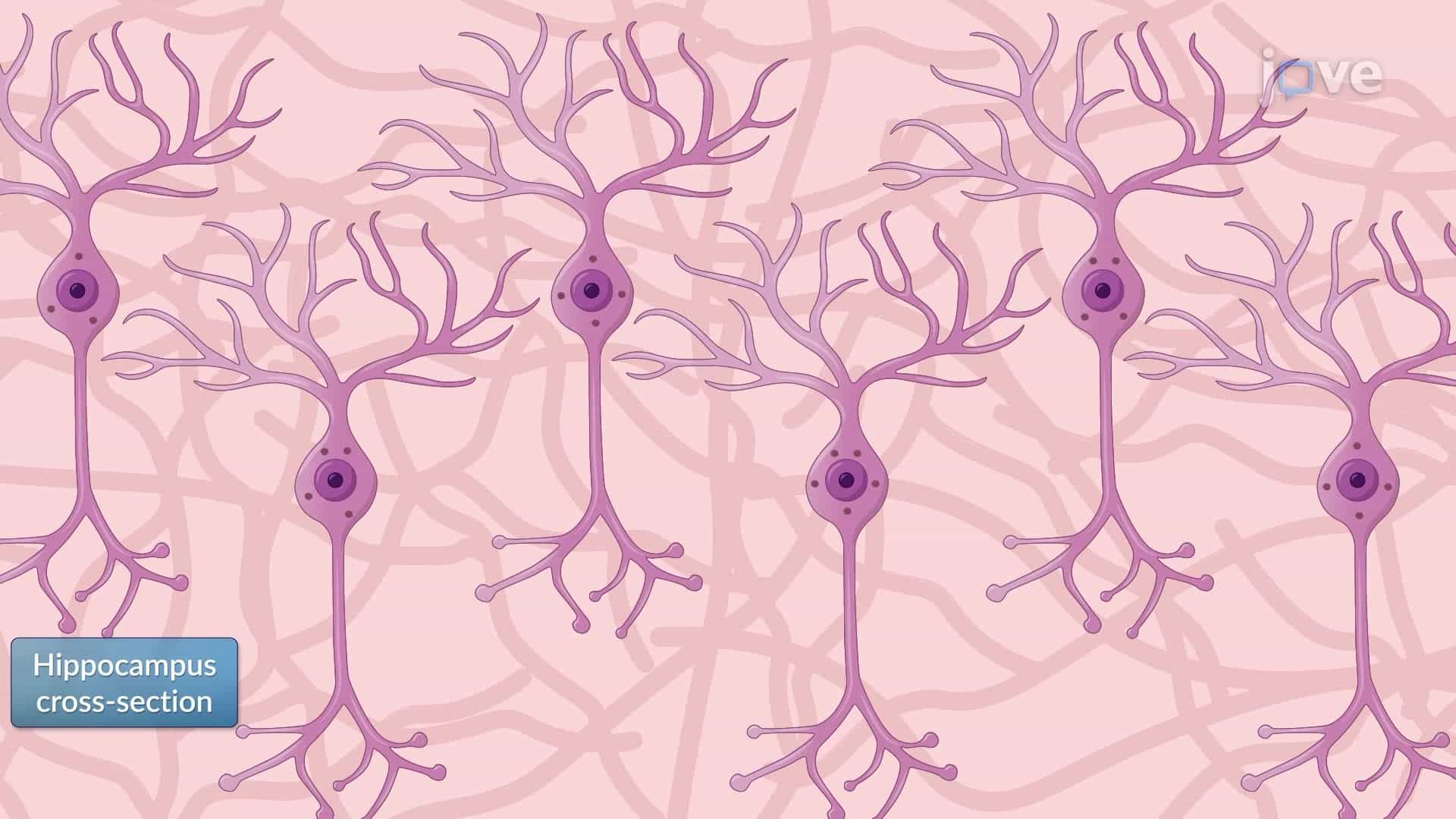 Silver Staining of Neurofibrillary Tangles in Brain Sections from a Mouse Model of Alzheimer's Disease