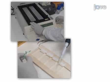 FISH for Pre-implantation Genetic Diagnosis