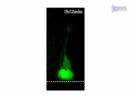Time-lapse Live Imaging of Clonally Related Neural Progenitor Cells in the Developing Zebrafish Forebrain