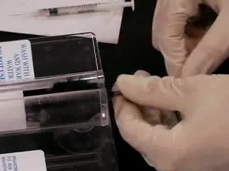Dissection and 2-Photon Imaging of Peripheral Lymph Nodes in Mice