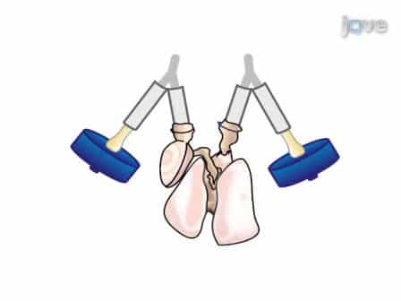 Procedure for Lung Engineering