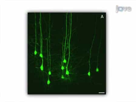 A Rapid Approach to High-Resolution Fluorescence Imaging in Semi-Thick Brain Slices