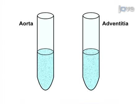 Flow Cytometry Analysis of Immune Cells Within Murine Aortas