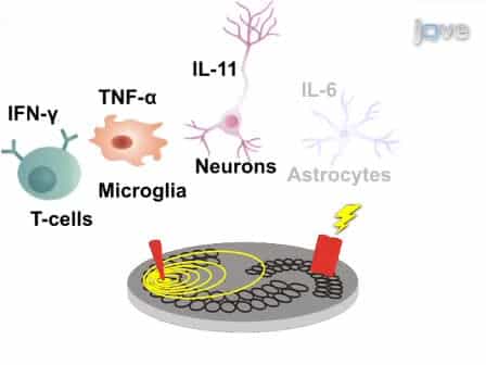 Modeling Neural Immune Signaling of Episodic and Chronic Migraine Using Spreading Depression In Vitro