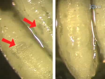 Drosophila Pupal Abdomen Immunohistochemistry