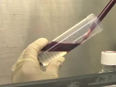 Enrichment of NK Cells from Human Blood with the RosetteSep Kit from StemCell Technologies