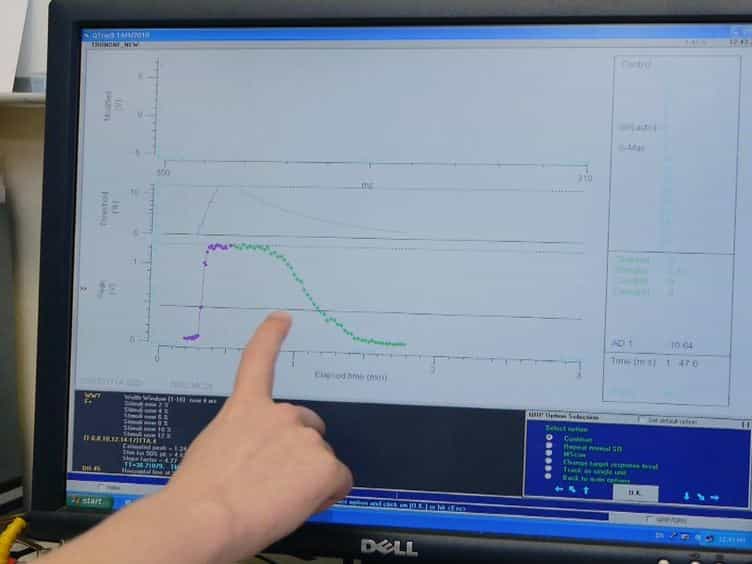 Nerve Excitability Assessment in Chemotherapy-induced Neurotoxicity