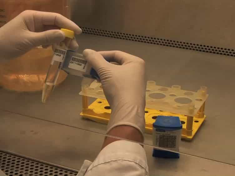 Diagnosing Pulmonary Tuberculosis with the Xpert MTB/RIF Test
