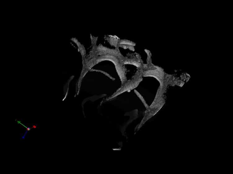 Ex vivo Mimicry of Normal and Abnormal Human Hematopoiesis