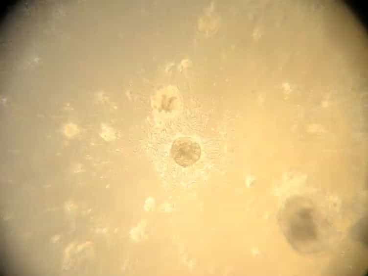 Isolation of Mammary Epithelial Cells from Three-dimensional Mixed-cell Spheroid Co-culture