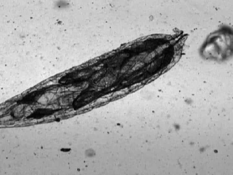 Simple Microfluidic Devices for in vivo Imaging of C. elegans, Drosophila and Zebrafish
