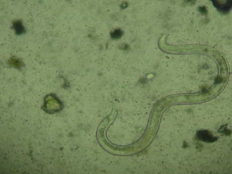 Determining Soil-transmitted Helminth Infection Status and Physical Fitness of School-aged Children