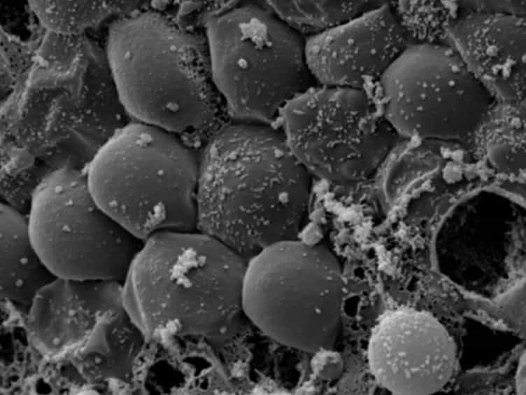 A Human Fallopian Tube Model for Investigation of C. trachomatis Infections