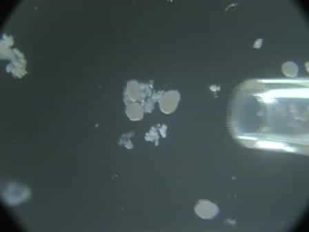 Transplantation of Pancreatic Islets Into the Kidney Capsule of Diabetic Mice
