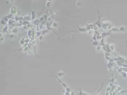 RNA Extraction from Neuroprecursor Cells Using the Bio-Rad Total RNA Kit