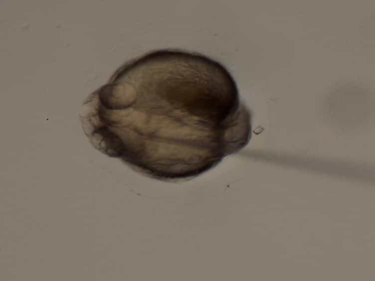 Manual Drainage of the Zebrafish Embryonic Brain Ventricles