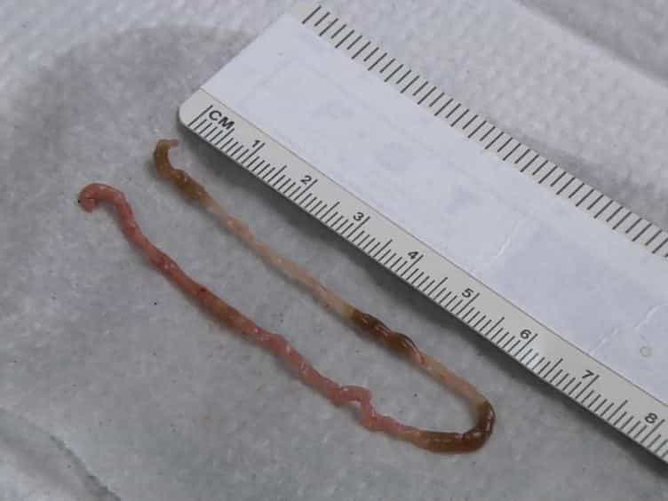 Tissue Engineering of the Intestine in a Murine Model