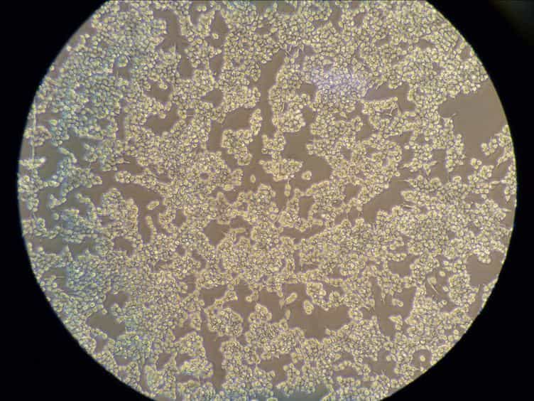 Plaque Assay for Murine Norovirus